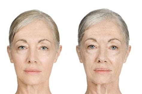3 Ways To Slow Down The Aging Process And Age Healthily Skin Skin