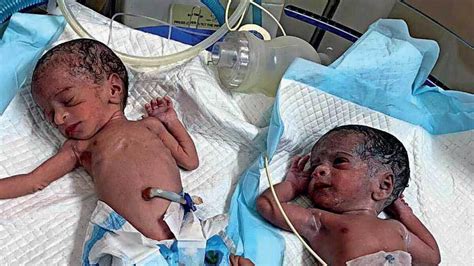74 year old woman gives birth to twins news khaleej times