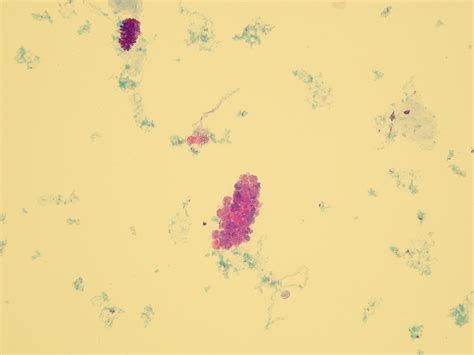 Casts Microscopic Analysis Of Urine Faculty Of Medicine Masaryk