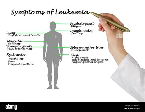 Common Symptoms Of Leukemia Stock Photo Alamy