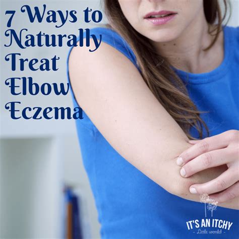 Natural Treatments For Elbow Eczema