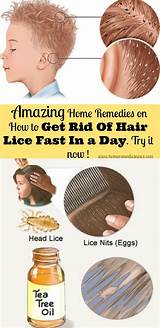 Pictures of Salt Water Lice Treatment