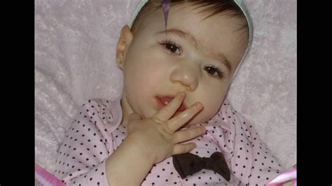 Sindrome De Patau Trissomia Do Cromossomo 13 Anna Beatriz 4 Anos De Muita Vida E Vitória