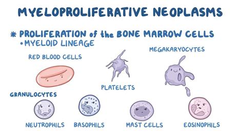 myeloproliferative neoplasms clinical practice osmosis