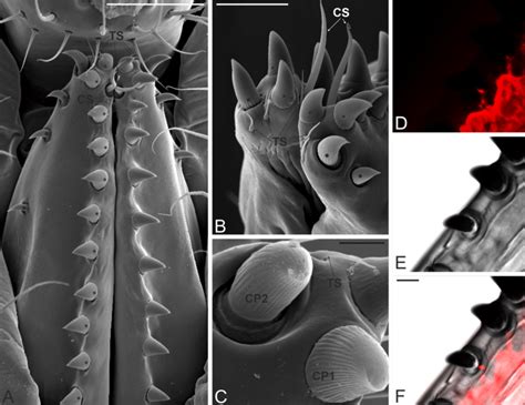Drosophila Suzukii Ovipositor Pegs And Sensilla Are Innervated Sensory Download Scientific