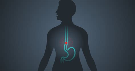 Lower Esophageal Sphincter And Its Anatomy A Guideline