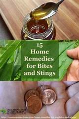Images of Home Remedies For Fire Ant Bites Itching