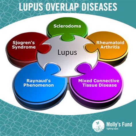 Early Lupus Symptoms What You Need To Look For Hubpages