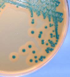 Required for growth on nutrient agar. rapidmicrobiology Archived News