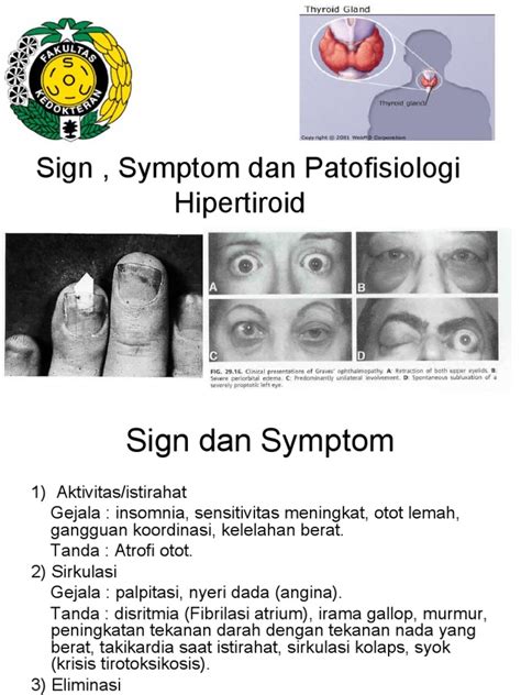 Tanda Gejala Dan Patofisiologi Hipertiroid Pdf