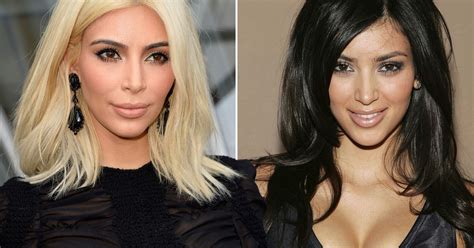 Kim Kardashian Accused Of Getting Plastic Surgery Despite Kanye Wests