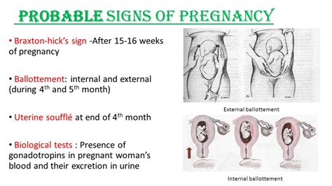 Osiander Sign In Pregnancy In Hindi Osianders Sign Means Pulsation