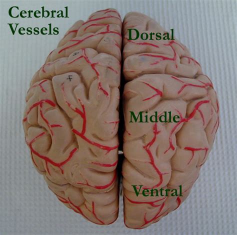 Fill in the blanks with the appropriate words to describe blood flow from the heart. Vessel Lab