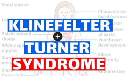 Klinefelter And Turner Syndrome Pathology Clinical Features Diagnosis And Treatment Youtube