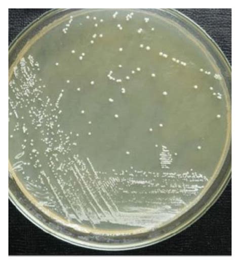 A Typical Isolated Colonies Of Lactobacillus Spp On MRS Media B