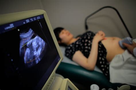 Can Ultrasound Be Wrong About Gender Mdrts