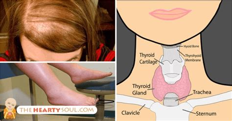 Complete List Of Hypothyroidism Symptoms With Checklist And Lab Guide