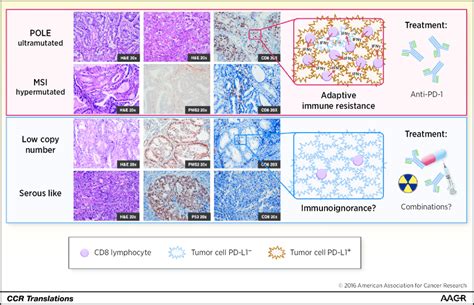 Molecular Approaches For Classifying Endometrial Carcinoma My XXX Hot