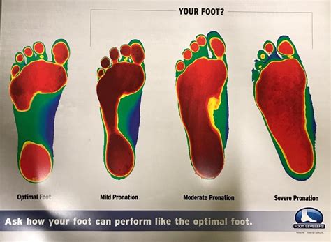 Have You Had A Foot Scan We Have 3d Foot Scans Available In Office