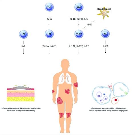 Immunological Similarities Between Psoriasis And Lung Diseases