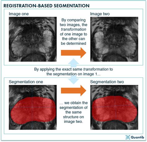 Deep Learning Applications In Radiology Image Segmentation