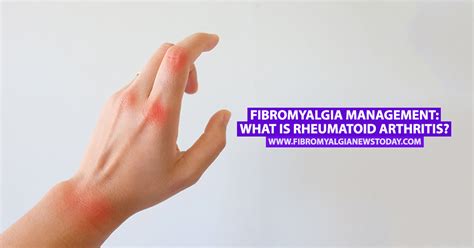 Fibromyalgia Management What Is Rheumatoid Arthritis