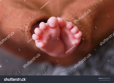 Photo Feet Newborn Baby Skin Peeling Stock Photo 630094730 Shutterstock
