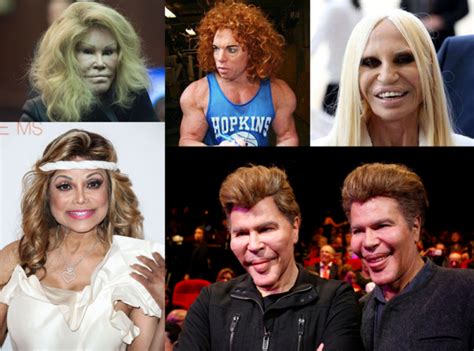 Top Worst Celebrity Plastic Surgery Disasters From Hollywood Vrogue Co