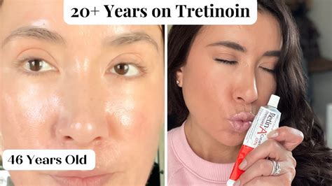 Tretinoin The Best Topical Anti Aging Cream See My Skin And What Ive Learned After 20 Yrs Of