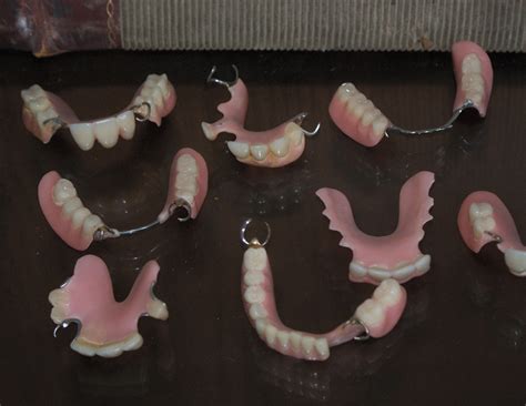 What Are Flexible Dentures How Are They Better Than Conventional