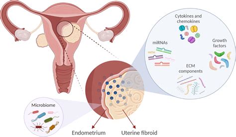 Frontiers Understanding The Impact Of Uterine Fibroids On Human