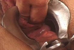 Thumbs Pro Pussymodsgalore Pussy Held Open With A Speculum An