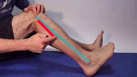 Strained Ankle Tendon And Ligaments The Treatment Guide