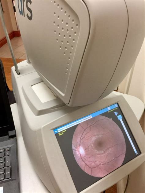 Importance Of Retinal Imaging As Part Of A Comprehensive Eye Exam