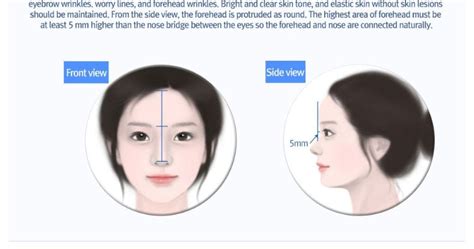 Three Different Types Of Forehead Surgeries