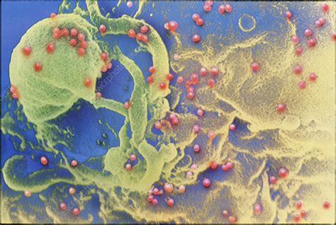 Coloured Sem Of Hiv On A White Blood Cell Stock Image M0500719