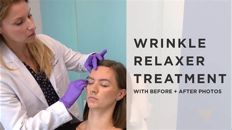Wrinkle Relaxer Injection Video With Before And After Youtube