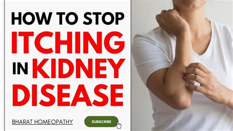 How To Stop Itching In Kidney Disease Bharat Homeopathy Youtube