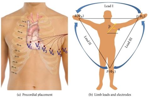 Twelve Lead ECG Electrode Placement And Lead Names 1 Open I
