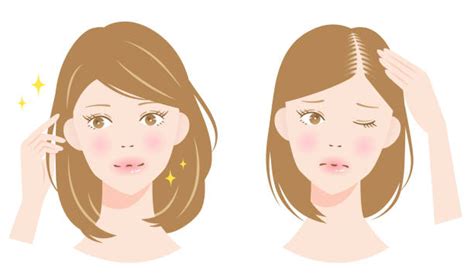 Woman With Thinning Hair Illustrations Royalty Free Vector Graphics