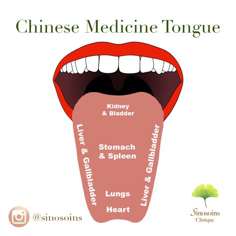 Chinese Medicine Tongue Map Clinic Sinosoins