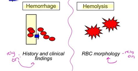 Regenerative Anemia Hemorrhage And Hemolysis Part 1 Flashcards Quizlet