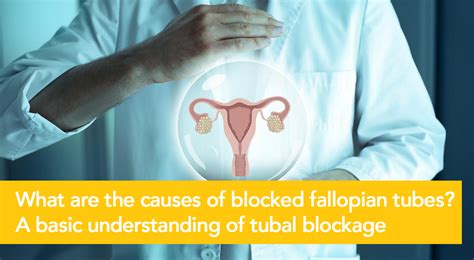 Blocked Fallopian Tubes Symptoms Causes Treatments
