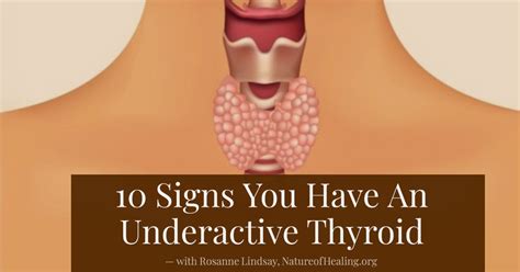 Ten Signs You Have An Underactive Thyroid Nature Of Healing