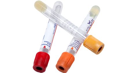 Gallery Of Bd Vacutainer Blood Collection Tubes Chart Vacutainer Bd