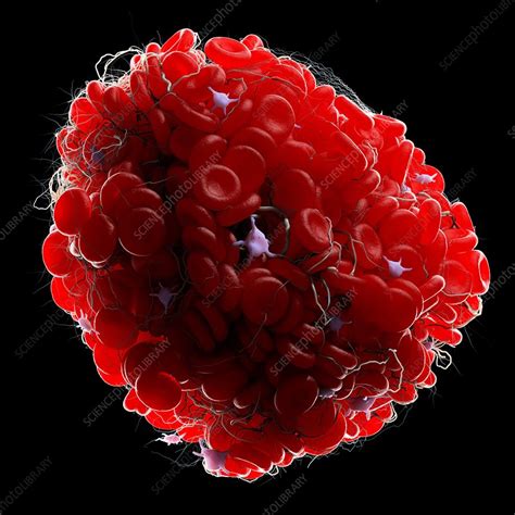 Blood Clot Illustration Stock Image F0349667 Science Photo Library