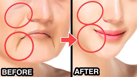 11 Mins Anti Aging Face Lifting Exercise With Spoon🥄 Reduce Sagging Jowls Get Younger Glowing