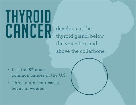 What Are Early Signs Of Thyroid Cancer Thyroid Cancer Symptoms And