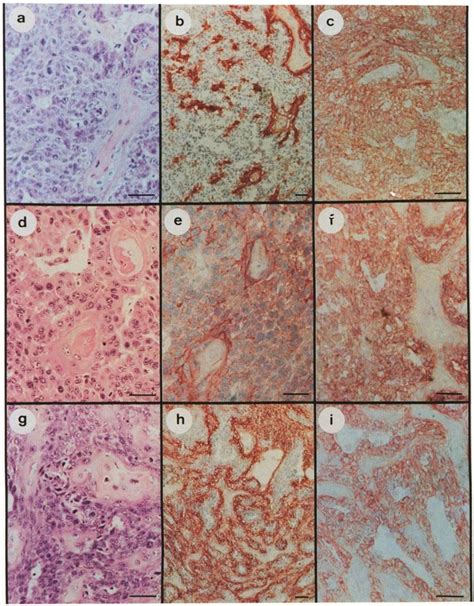 Histology And Immunohistochemical Localization Of E And P Cadherin In