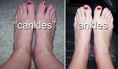 Not So Daily But Still Here Cankles